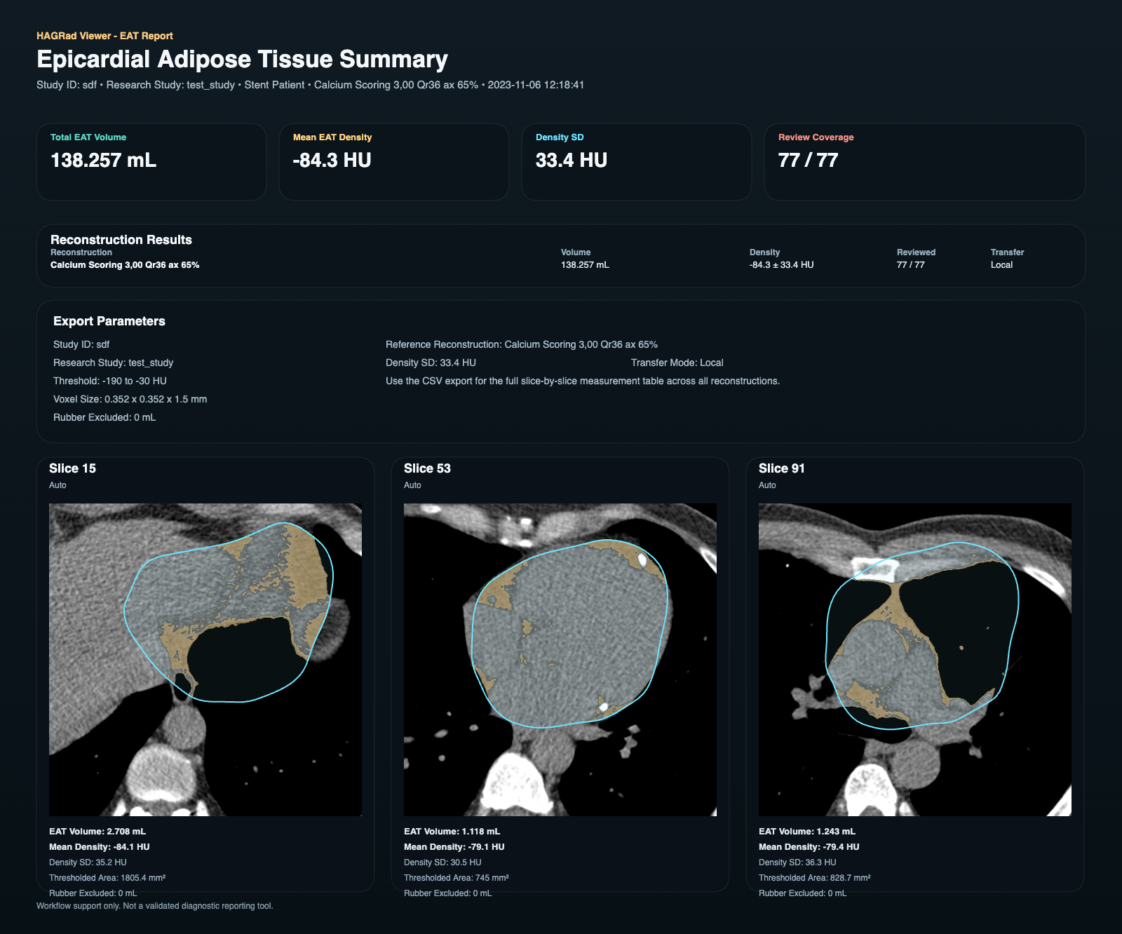 HAGRad EAT report showing epicardial adipose tissue volume, density, review coverage, and example segmented cardiac CT slices.